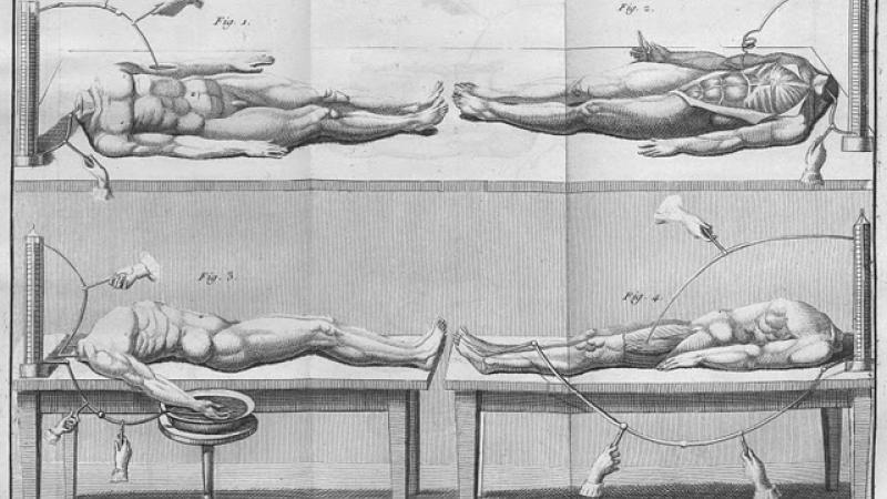 Human dissection engraving - Wellcome Collection.