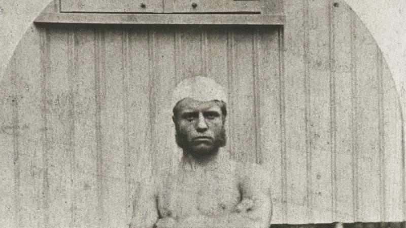 Young teddy roosevelt, shirtless and wearing a skullcap, sitting with his arms folded across his chest