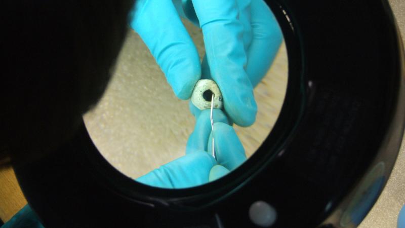 Close-up of a copper bead during condition assessment